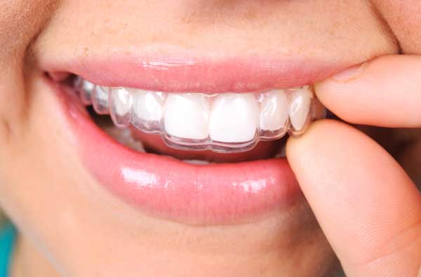 Woman using clear aligner at The Center for Esthetic Dentistry in Grants Pass, OR