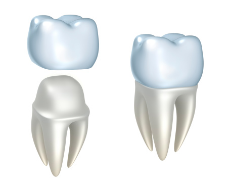 A rendering of a porcelain crown on tooth at The Center for Esthetic Dentistry in Grants Pass, OR