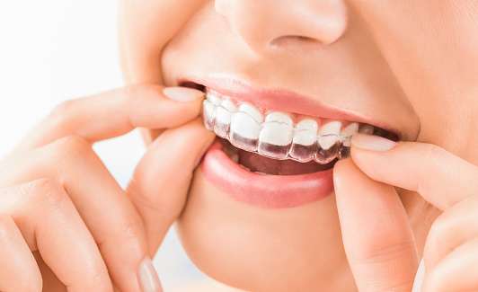 Close up of woman placing guard into mouth